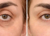 کرم دور چشم لاکچری کوین