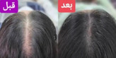 سرم سیرسیاه لاکچری کوین فرانسه