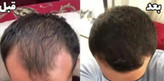 سرم سیرسیاه لاکچری کوین فرانسه